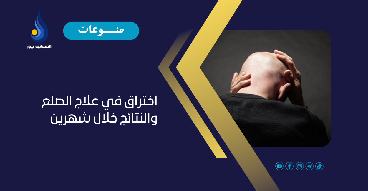 اختراق في علاج الصلع والنتائج خلال شهرين